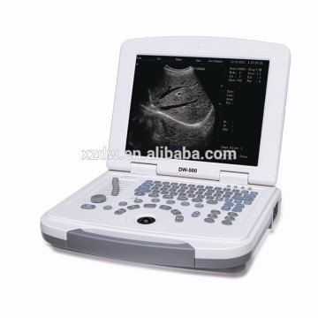 DW500 12 polegada tela LED barato hospital médico uso laptop ultra-sônico máquina e laptop máquina ultra-sônica